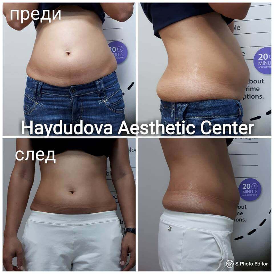 Haydudova Aesthetic Center – център за естетични процедури