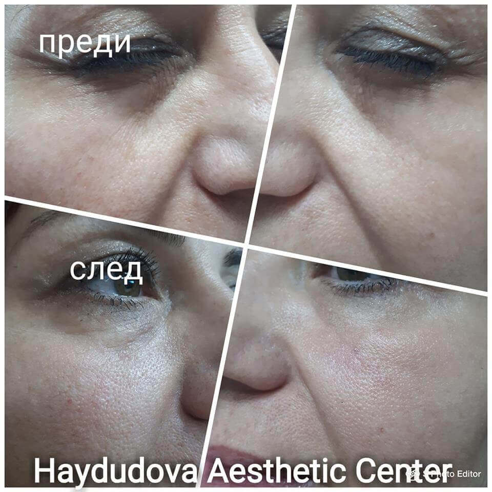 Haydudova Aesthetic Center – център за естетични процедури